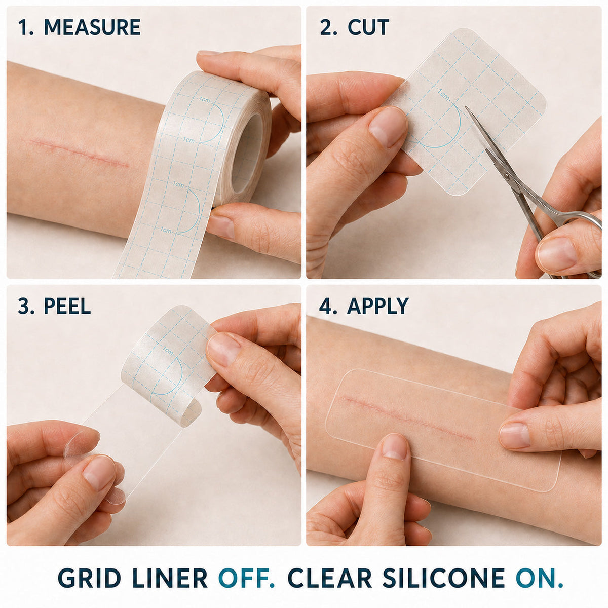 👩‍⚕️👩‍⚕️Trilumia® Silicone Scar Therapy Roll — Custom-Fit Care for Long, Raised Surgical Scars