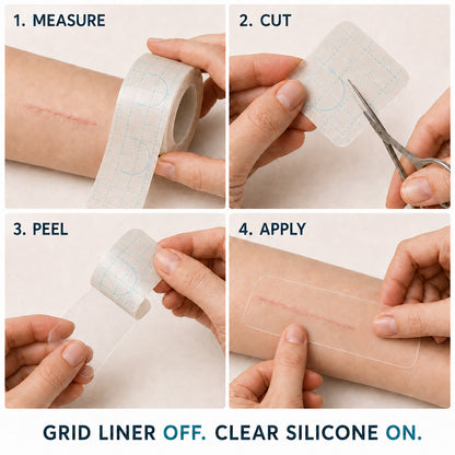 👩‍⚕️👩‍⚕️Trilumia® Silicone Scar Therapy Roll — Custom-Fit Care for Long, Raised Surgical Scars